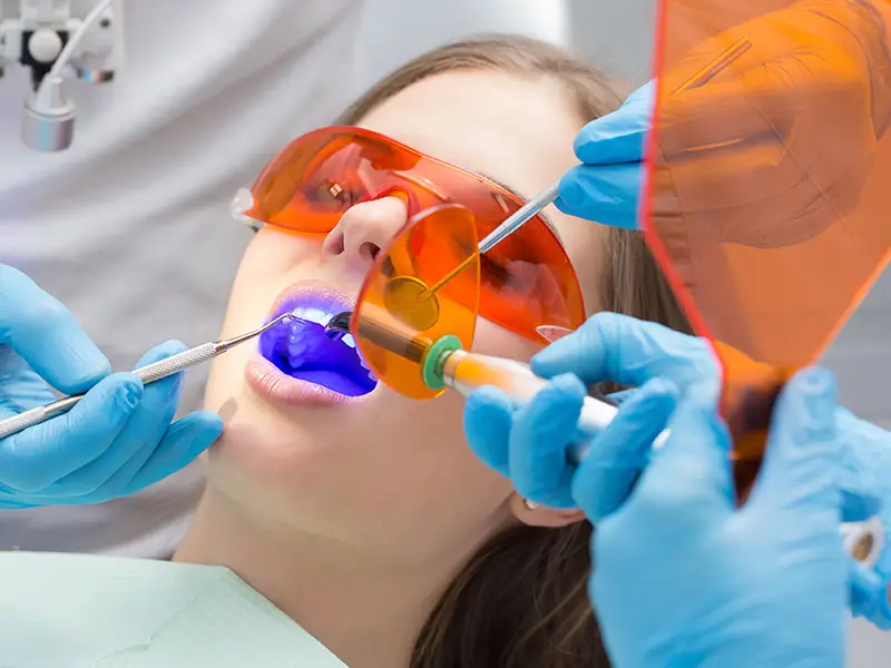 blanqueamiento-dental-clinica-valencia-ciutat-vella